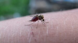 脂肪吸引後の肌質変化について知っておくべきことは？